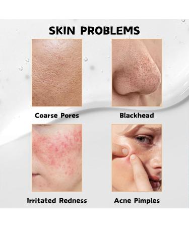 Facial Cleanser - Clean and Clear Face Wash - Face Wash Women for Cleaning & Tightening Pores - Foaming Cleanser - Face Wash for Balanced Grease & Reduce Acne - Skin Care - Face Cleanser - Buy Online on GoSupps.com