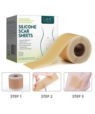 Silicone Gel Tape Roll for Scar Removal - Hypertrophic Scars & Keloids - Pain-Free & Water-proof (1.6 x 120) - Buy Online on GoSupps.com