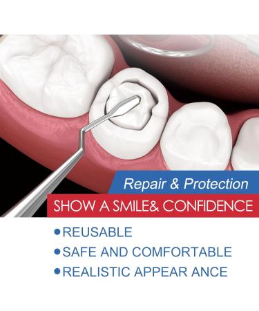 Temporary Tooth Repair Kit | Instant Dental Repair Set for Missing & Broken Teeth | Prosthesis Veneers & Granules - Buy Online on GoSupps.com