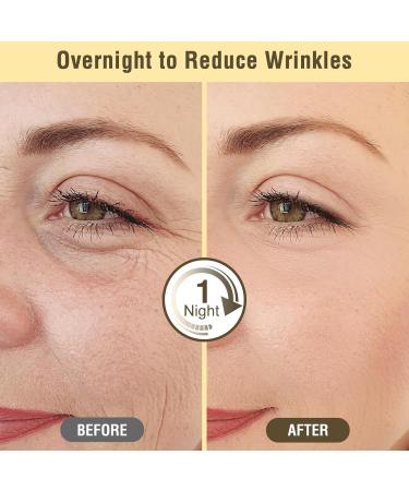 Reusable Silicone Wrinkle Patches Kit - Face & Forehead Wrinkle Treatment with Massage Stick | Overnight Patches for Under Eyes & Facial Care - Buy Online on GoSupps.com