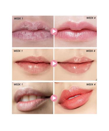 30g Lip Peeling Balm for Women | Brightening Exfoliating Scrub & Moisturizer for Cracked Dull Lips | Perfect Gift for Dark Lip Care - Buy Online on GoSupps.com