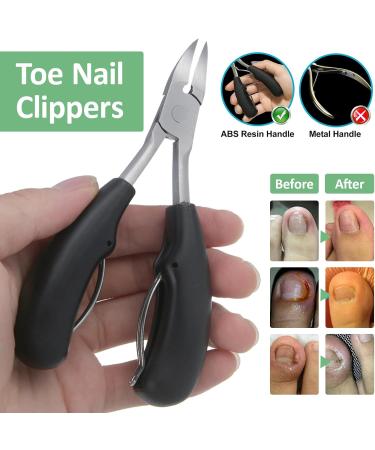 XdealCozyxc Ingrown Toenail Tool Kit with File and Lifter Ingrown Toenail Corrector Strips and Patch for Toe Pain Relief - Buy Online on GoSupps.com