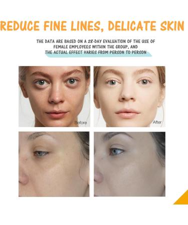 Vitamin C Face Serum Antioxidant Face Serum for Dullness Acne Facial Serum Anti Ageing & Smooth Fine Lines Hyaluronic Acid Serum for Face Firming Face Serum for Wrinkle Promote Skin Elasticity-30ml - Buy Online on GoSupps.com