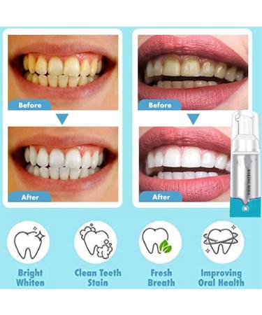 MTDBAOD Deep Cleaning Foam Toothpaste Foam Whitening Toothpaste Citrus Baking Soda Toothpaste Ultra-Fine Mousse Foam Deeply Cleaning Gums Intensive Stain Removal Toothpaste (2Pcs) - Buy Online on GoSupps.com