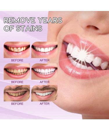 Purple Teeth Whitening Toothpaste - Stain Remover & Color Corrector for Yellow Teeth - Buy Online on GoSupps.com