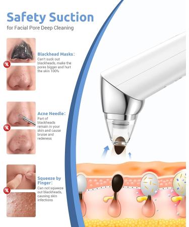 Blackhead Vacuum Remover | Rechargeable Electric Pore Cleaner Kit with 5 Suction Probes - Buy Online on GoSupps.com