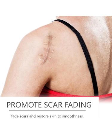 mother Scar ointment after op scar ointment for old scars versatile scar cream for surgical scars caesarean section acne scars burns keloids 30 g - Buy Online on GoSupps.com