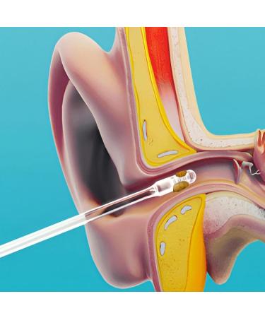 Ear Scratcher Ear Cleaners for Adults | Reusable Ear Cleaner Soft Resin Ear Wax Removal Tool Ear Wax Remover Ear Picker Ear Wax Removal Kit for Olderly Adult Kids Hondony - Buy Online on GoSupps.com