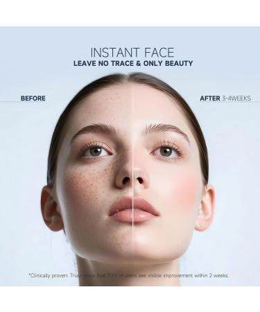 OIDLA Dark Spot Remover for Face and Body, Corrector Cream, Sun and Age Spot Treatment, Rapid Tone Repair Retinol (1 Fl Oz) - Buy Online on GoSupps.com