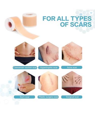 Medical Grade Silicone Scar Sheets Roll - 1.6 x 120 inches, 3M Brand - For C-Section, Surgery, Burn, Keloid, Acne - Reusable & Washable - Scar Removal Treatment - Buy Online on GoSupps.com