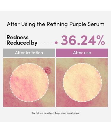 LAGOM Cellus Refining Purple Serum, 10% Azelaic Acid, Ceramide&Panthenol, Herb Extract, Sensitive skin, Redness Soothing, Spot Care, Korean Skincare 1.18 Fl Oz - Buy Online on GoSupps.com