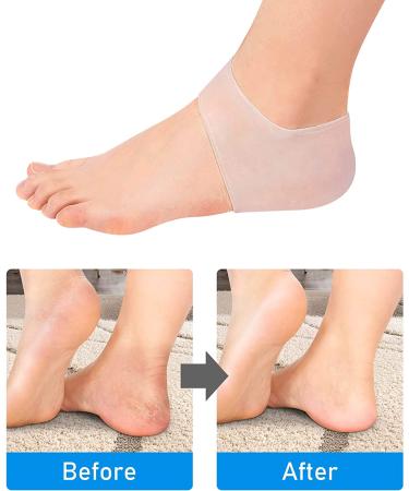 Dr. Pedi Gel Heel Sleeves - Unisex Silicone Cushion for Heel Spur Relief and Moisturizing - Reduce Pain of Plantar Fasciitis - Buy Online on GoSupps.com