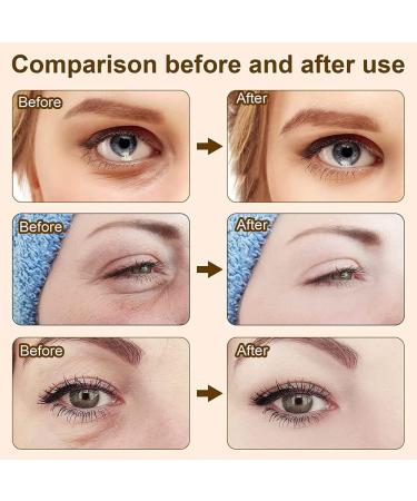 30g Female Eye Cream - Snake Venom Anti-Wrinkle & Eye Bag Removal - Buy Online on GoSupps.com