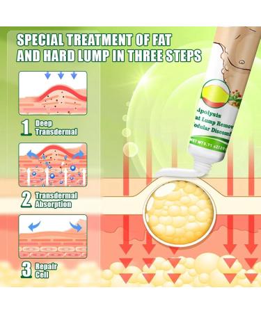Lipoma Removal Cream Pommade Apaisante pour Les Lipomes Cr me Naturelle D' limination des Lipomes Ingr dients S rs R sultats Rapides - Buy Online on GoSupps.com