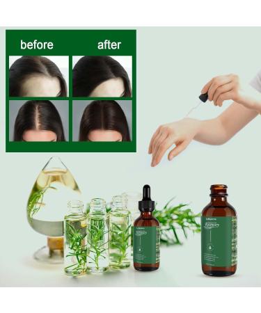 Rosemary Essential Oil Rosemary Hair Oil for Hair Growth Nourishes the Scalp Improves Hair Loss Organic Rosemary Essential Oil Stimulates Hair Growth for Eyelashes and Eyebrows - Buy Online on GoSupps.com
