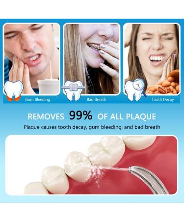 Apiker Water Flosser with 8 Tips, 10 Pressure Settings and 600ml Tank - Family Dental Oral Irrigator for Teeth Braces (White) - Buy Online on GoSupps.com