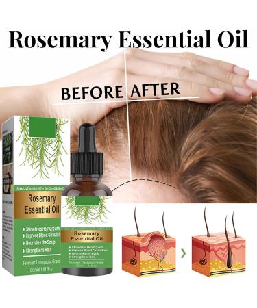 60ML Rosemary Oil for Hair Rosemary Oil Skin Care-Pure Organic for Eyelashes Eyebrows Face Stimulates Growth Nourishes Scalp - Buy Online on GoSupps.com