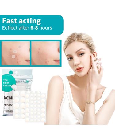 Vemfay Pimple patches 528 pieces Hydrocolloid acne patch Invisible natural pimple patch Can be used day and night 2 in 1 With tea tree oil and salicylic acid 4 sizes 8101315 mm - Buy Online on GoSupps.com