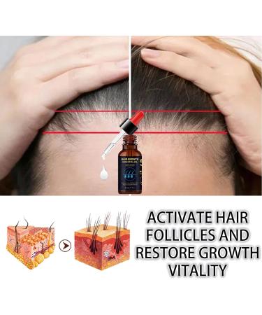 Nourishing Hair Growth Oil Serum for All Hair Types - Stimulates Scalp, Thickens and Promotes Density - 1pcs - Buy Online on GoSupps.com