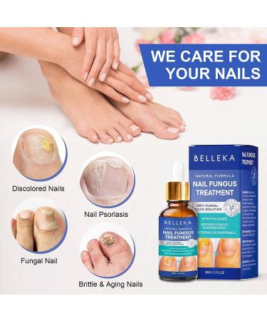 Fungus Nail Treatment - Extra Strength Toenail & Fingernail Repair Solution - Buy Online on GoSupps.com