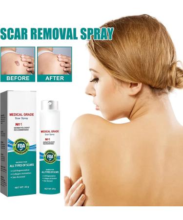 Scarremove Advanced Scar Spray - Gentle Skin Care for Acne Prone Skin - Acne & Dark Spot Remover - 1Pcs - Buy Online on GoSupps.com
