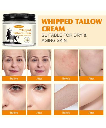 Grass-Fed Tallow & Raw Honey Balm | Whipped Skin Cream for Face & Body | Soothes & Repairs Dry Sensitive Skin | Organic All-Natural Deep Hydration (2.1 oz) 2.1 Fl Oz (Pack of 1) - Buy Online on GoSupps.com