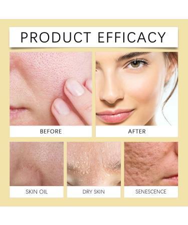  Orgrul Pack of 2 Active Resin Plus Ointments - For Enlarged Pores - Cream for Irritated and Dry Skin - Moisturizing Cream for All Skin Types - 100g - Buy Online on GoSupps.com