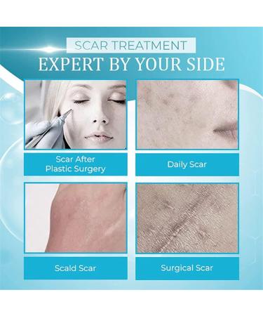  Anshka Organic scar removal gel natural scar therapeutic gel scar removal cream for old scars scar repair gel cream for men and women 1 piece - Buy Online on GoSupps.com