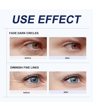 Collagen Eye Cream - Eye Cream for Dark Circles and Puffy Eyes - Eye Cream Anti Aging - Moisturizing Skincare Set for Hydrating and Moisturizing - Brightening Skin Color - Buy Online on GoSupps.com