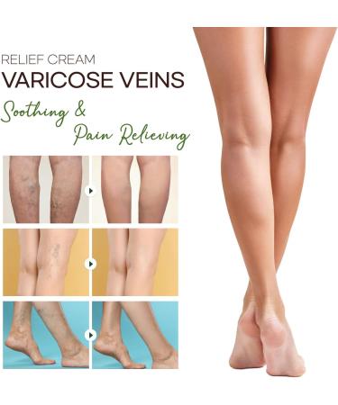 Varicose Veins Cream - Effective Relief & Improved Blood Circulation for Legs | Soothing 2oz Vein Cream - Buy Online on GoSupps.com