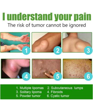 Delipidation Cream for Lipoma Removal and Anti-Swelling - Cellulite Ointment for Lipoma Lumps - Buy Online on GoSupps.com
