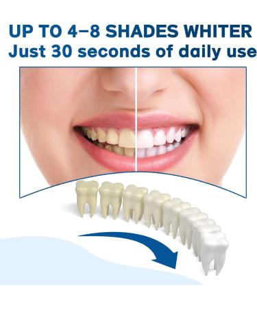 Teeth Whitening Pen (2 Pens) Kit - Sensitivity-Free Gel for Brighter Teeth - 20+ Uses, Travel-Friendly & Painless - Mint Flavor - Buy Online on GoSupps.com