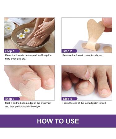 Ingrown Toenail Treatment Kit | Pain Relief Tool for Easy Trimming | Soften Nails & Straighten | Toenail Pain Relief Oil Drops | Natural 50 Patch Treatment - Buy Online on GoSupps.com