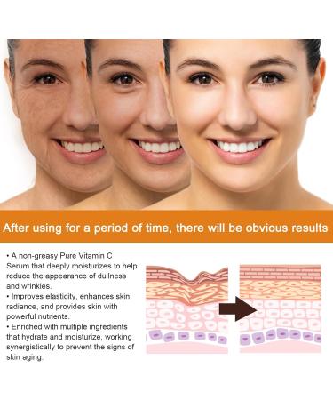Vitamin C Face Serum for Wrinkle Vitamin C and E Serum Hyaluronic Acid Face Serum for Dark Spot Anti Aging & Even Skin Tone Nicotinamide Eye Serum Vitamin E Facial Serum High Hydrating Plump Skin - Buy Online on GoSupps.com