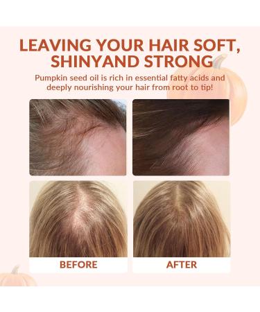 Pumpkin Seed Oil Capsules 2 in 1 Pumpkin Seed Oil with Saw Palmetto for Hair Growth 3000mg Per Serving Cold Pressed Supports Hair Heart Skin Supplement Non-GMO Gluten Free 300 Softgels - Buy Online on GoSupps.com