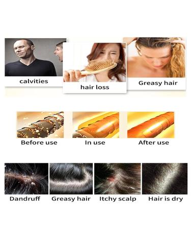 Purple Shampoo Bar Set for Gray Hair - 2 Natural Bars for Thinning Hair - Ideal for Men & Women 55g - Buy Online on GoSupps.com