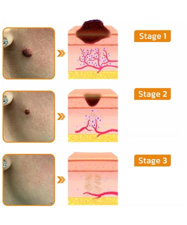 FROPUN Bee Venom Removal Cream - 100% Natural Fast-Acting Repair Cream for Adults - Maximum Strength Skin Care for Men & Women (1 Floz - Buy Online on GoSupps.com