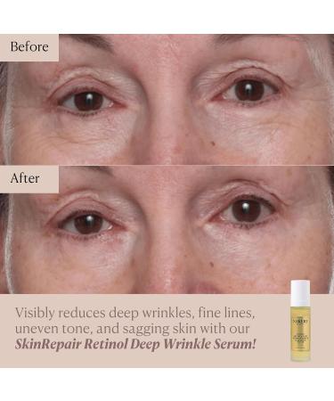 Nakery SkinRepair Retinol Deep Wrinkle Serum (2.02 Fl Oz) Anti Aging Face Serum with Encapsulated Retinol NAD+ Complex Ceramide NP Hydrating Firming Skin Treatment for Fine Lines - Buy Online on GoSupps.com