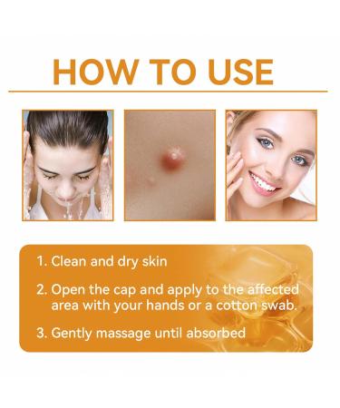 FROPUN Bee Venom Treatment Cream | Acne & Skin Repair | Hydrating Cream for Men & Women | 1 Fl Oz - Buy Online on GoSupps.com