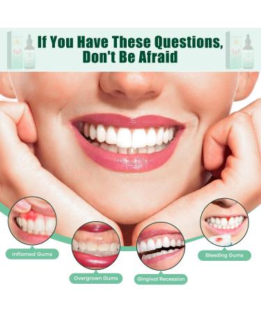 2 PCs Dentizen Gum Regrowth Drops - Promote Healthy Gums & Effective Teething Relief - Buy Online on GoSupps.com