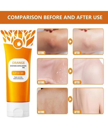 Orange Exfoliating Gel for Face & Body Orange Exfoliante Scrub Peeling Gel Exfoliating Cleansing Scrub Deep Cleansing Moisturizing Facial Exfoliator Remove Blackheads for All Types Skin (2pcs 1) 2pcs 1.75 Fl Oz (Pack o  - Buy Online on GoSupps.com