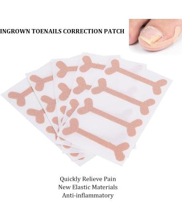 Ingrown Toenail Patch Nail Picker Pedicure Tool 20 Adhesive Stickers Toenail Correction Relief Prevention Suitable for Ingrown Thick Nails - Buy Online on GoSupps.com
