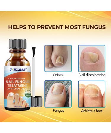Maximum Strength Nail Repair Treatment for Toe and Fingernail Fungal Repair - Hydrates and Renews Damaged Nails - Buy Online on GoSupps.com
