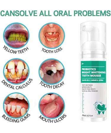 Lenaro Probiotics Teeth Whitening Mousse - 2PCs Herbal Oral Repair for Bright Smiles & Fresh Breath - Buy Online on GoSupps.com