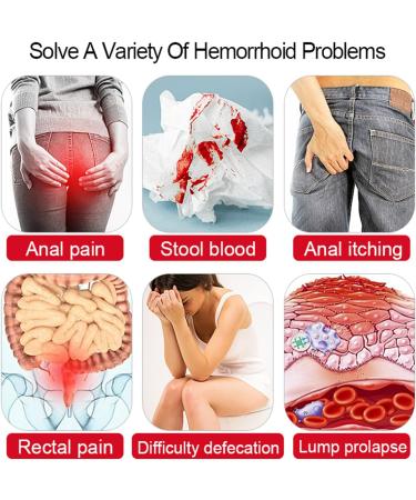 EKYOSHCZ Natural Herbal Hemorrhoid Capsules - Rapid Pain Relief (2 Pcs) - Buy Online on GoSupps.com