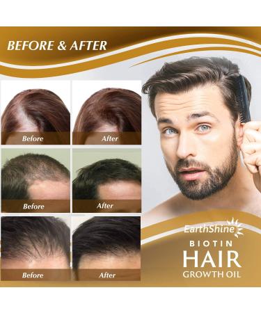 Hair Growth Serum - Biotin Oil for Thicker, Stronger Hair | Prevent Hair Loss - 1.18 Oz - Buy Online on GoSupps.com