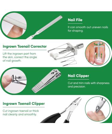Ingrown Toenail Tools Kit - Stainless Steel Treatment & Corrector for Pain Relief | Pedicure Essentials - Buy Online on GoSupps.com