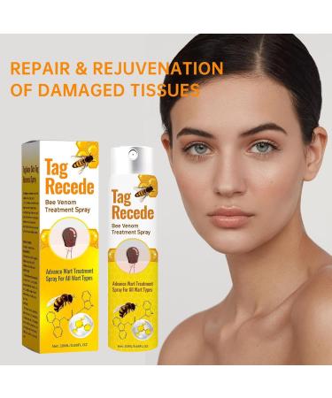 Birthmark Removal Cream Skin Tag Spray Skin Lightening Fast Acting 20ml Natural Painless Plant Extracts For Men Women Legs Back Feet - Buy Online on GoSupps.com
