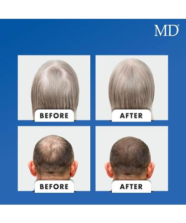 Nutri Hair Growth Supplement with Biotin (30 Capsules) | Prevent Hair Loss & Promote Stronger Thicker Hair | Ideal for Hair Health - Buy Online on GoSupps.com