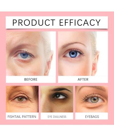 Retinol Eye Cream Eye Cream for Dark Circles and Puffy Eyes Retinol Eye Serum Under Eye Cream for Women/Men Skincare Eye Cream Anti Aging Anti Wrinkles Reduce Eye Bags Fine Lines 20g - Buy Online on GoSupps.com